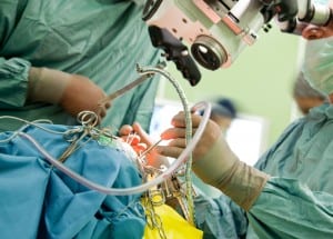 Neurochirurgische ingreep