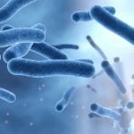 legionella